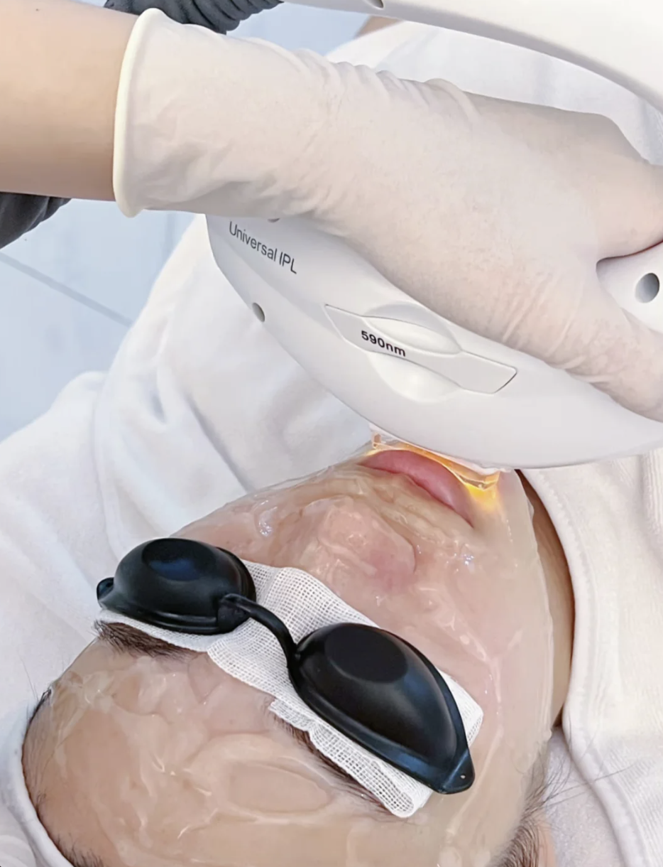 Chăm sóc da công nghệ cao IPL tại Mê Beauty